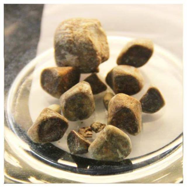 肥胖已经成为人类健康第一杀手?几组健康数据告诉你