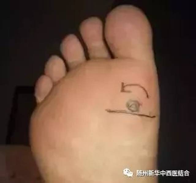 脚上有一组生命密码,一病一绝招,太难得了!