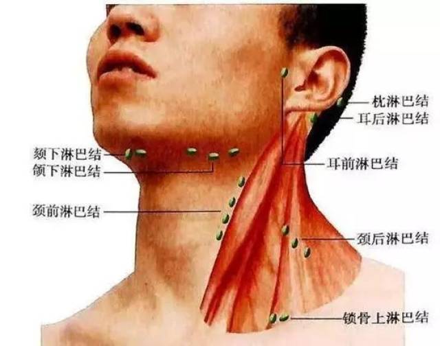 杭州男子脖子鼓出个疙瘩,一查竟是肺癌!这些事你千万不能忽视