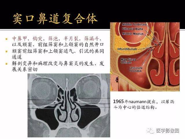 福利來了,超級詳盡的鼻腔,鼻竇,顱底ct解剖丨影像天地