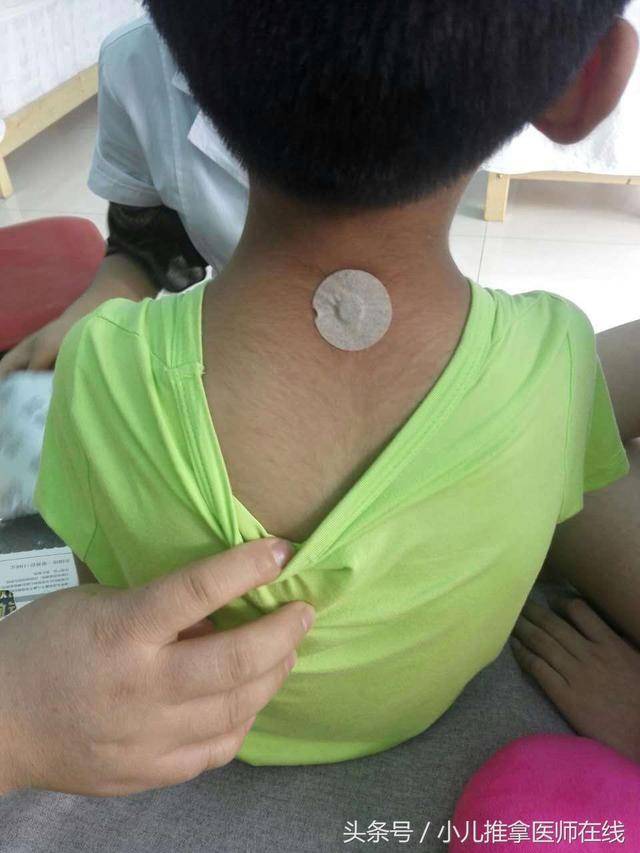 2,发烧贴在曲池穴,大椎穴