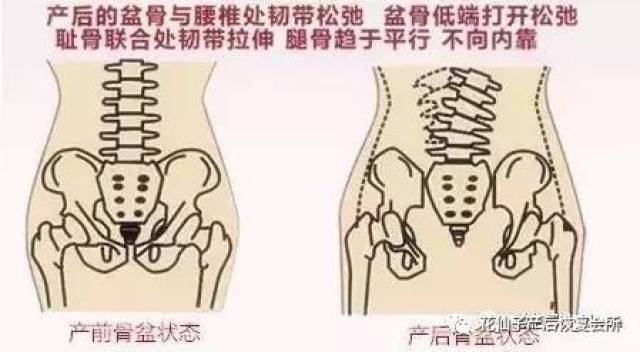 淮南產後寶媽自我檢測骨盆是否有問題