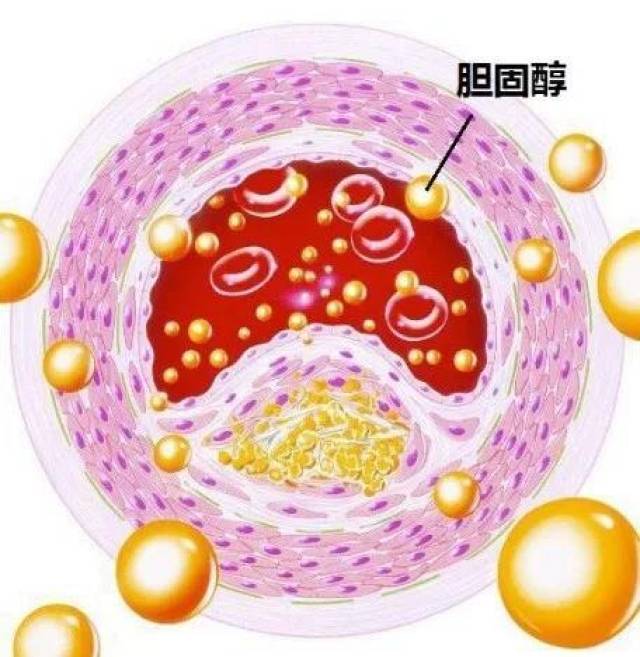 如何降低胆固醇?