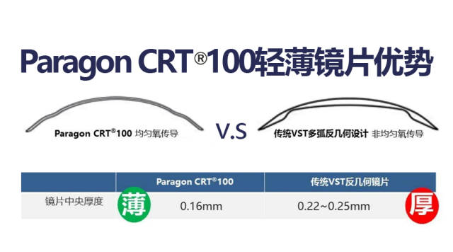 crt角膜塑形鏡:白天摘 晚上戴