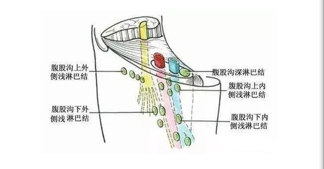 腹股沟淋巴结的位置图片