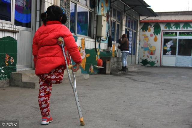 3岁女孩遇车祸截取右腿