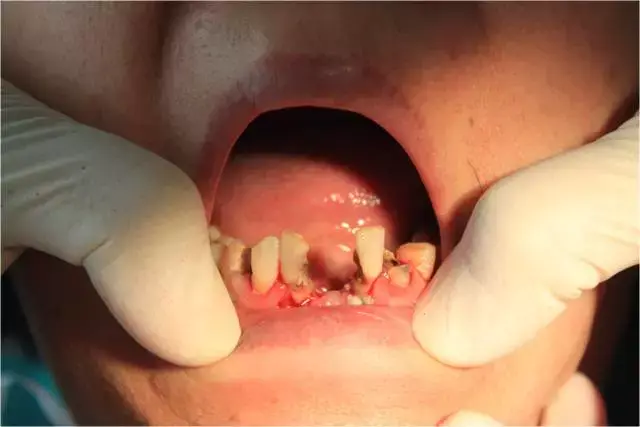 带着微笑,静待春暖花开