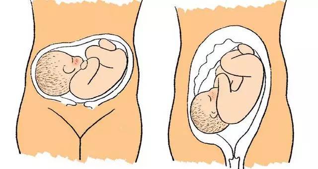 其实根据胎宝宝打嗝的位置,孕妈妈还能判断宝宝的胎位.