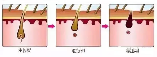 毛发生长周期示意图图片