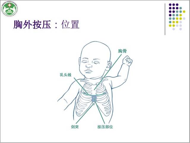 每分钟40~60次每分 马兰教授讲解正压通气装置 胸外按压指征