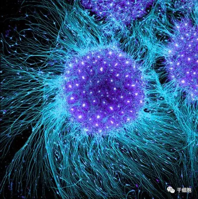 神奇的干细胞让人体受损肌肉皮肤和肌体重获新生