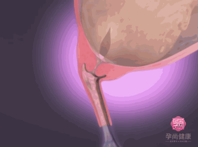 629_468gif 动态图 动图