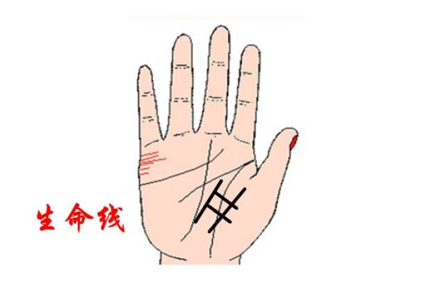 井字纹出现在食指下