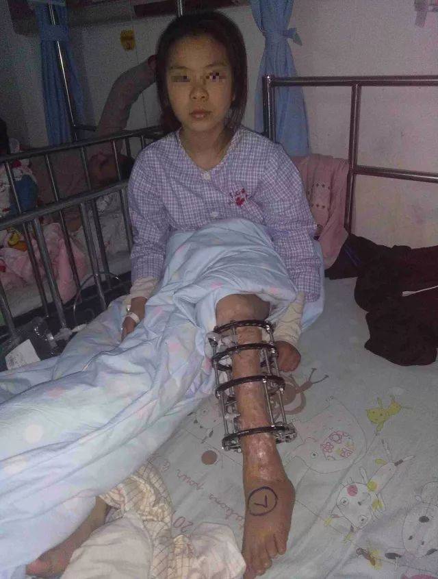 小女孩车祸失去双腿图片