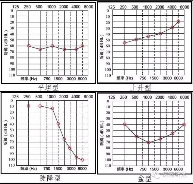 传导性耳聋听力图图片