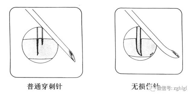 输液港无损伤针如何选择?_手机搜狐网