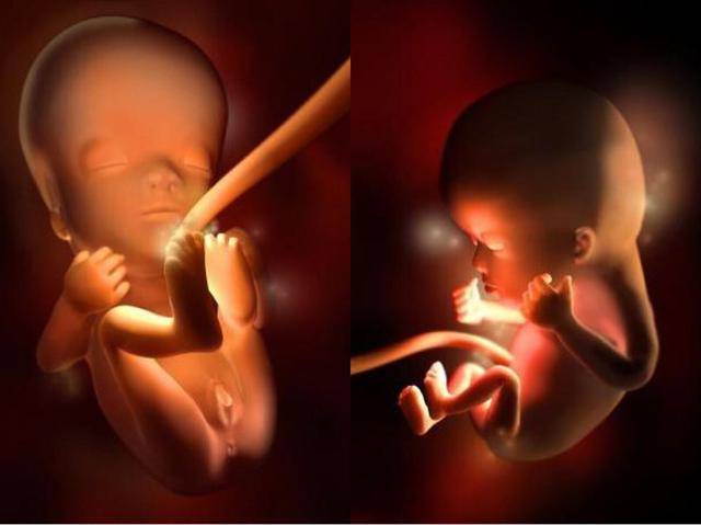 11周胎儿有多大图片