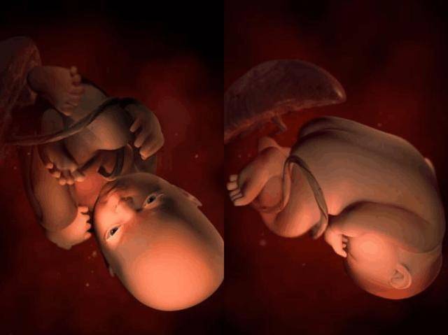 孕37周胎儿腹中图片图片