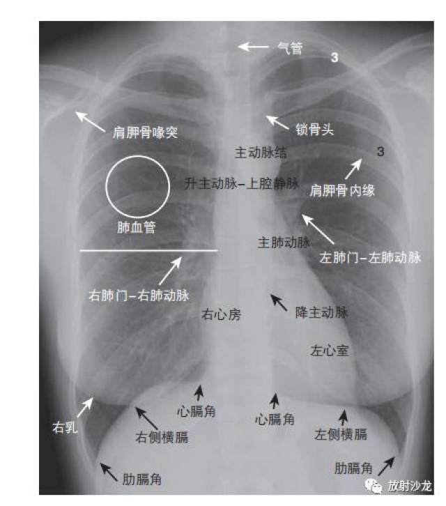 x线侧位胸片的5个关键区域