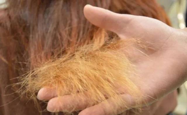 为什么头发会枯黄?是怎么造成的?