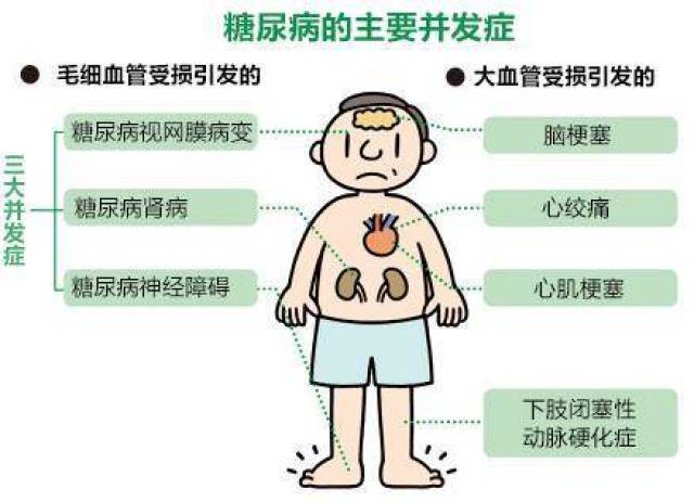 糖尿病年轻化,很遗憾4种类型3类症状4大并发症,大多数人不知道