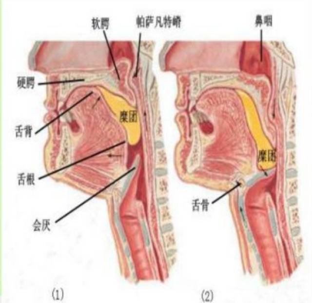 咽后壁的位置示意图图片