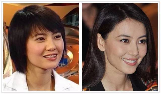 很多女明星都因为整牙颜值有了很大提升,比如下图的高圆圆,其实还有
