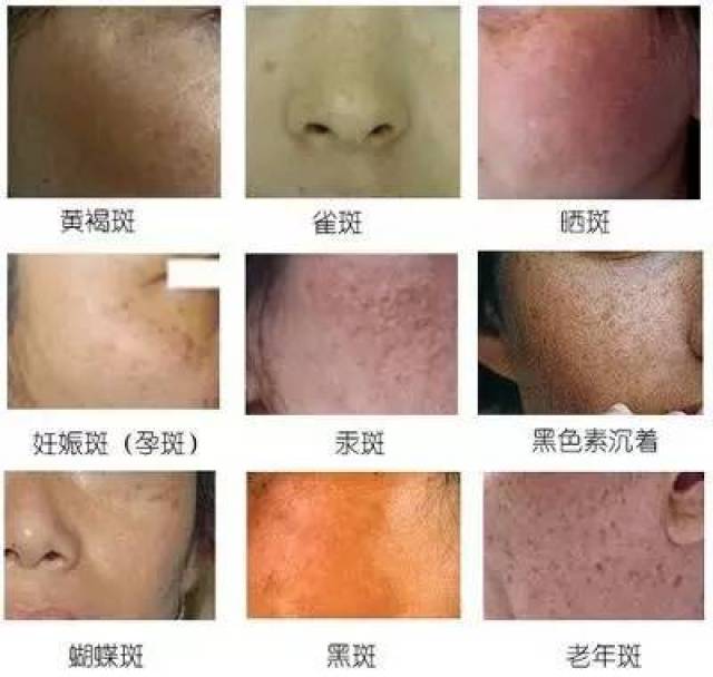 吴昕被称东北小赫本?不好意思,赫本没斑