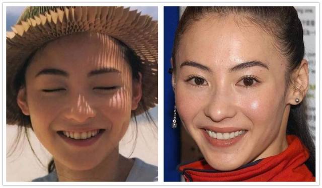 整牙变丑的原因有两个,第一个原因是如果你有虎牙,或者牙齿比较尖