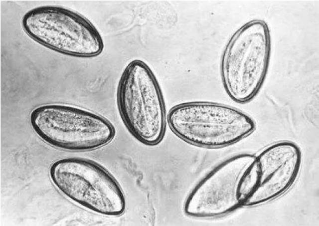 宝宝肛门蛲虫虫卵图图片