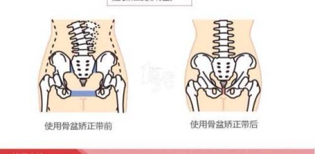 顺产骨缝开全示意图图图片