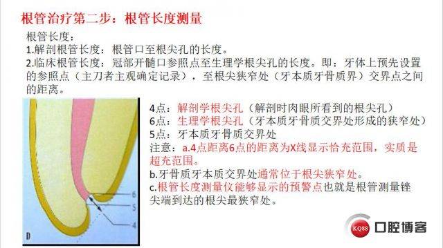 《牙医养成记:根管长度的测量》
