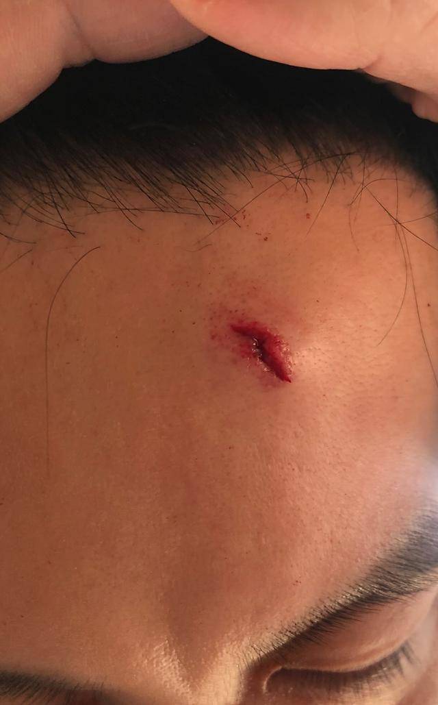 李晨"纹"小猪佩奇遮伤口,范冰冰却专注吐槽皮肤问题并传授护肤经验!