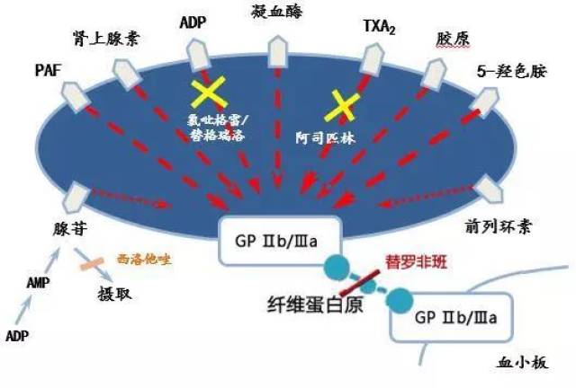 ccif 2018|优化pci围术期抗血小板治疗方案探讨—替罗非班(欣维宁)