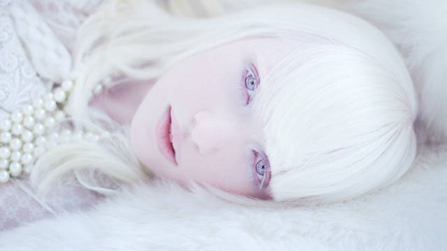 得了白化病怎么办?不妨了解下白化病基因检测——佳学基因