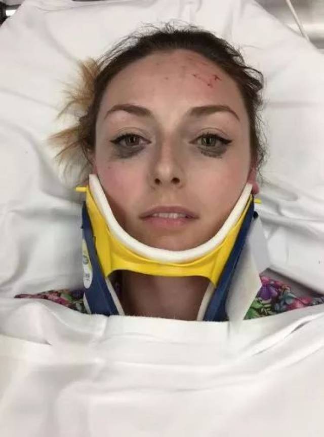 被救护车紧急送到医院时,妹子的颈部,头部,膝盖都不同程度的受伤了.