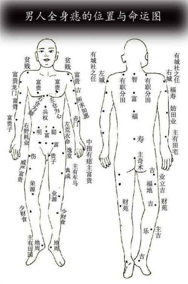 一等好命痣图片