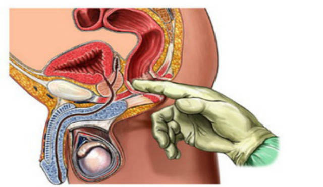 前列腺尖部位置图图片
