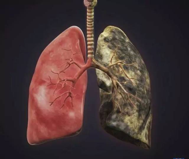 肺图恶心图片