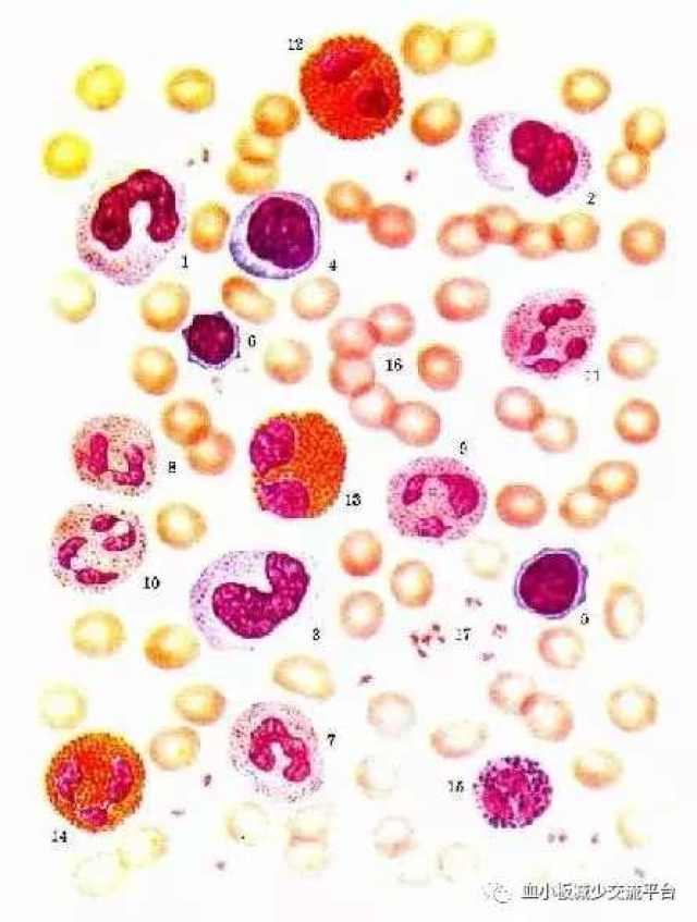 褚长龙大夫带你了解血小板增多症病因如何治疗