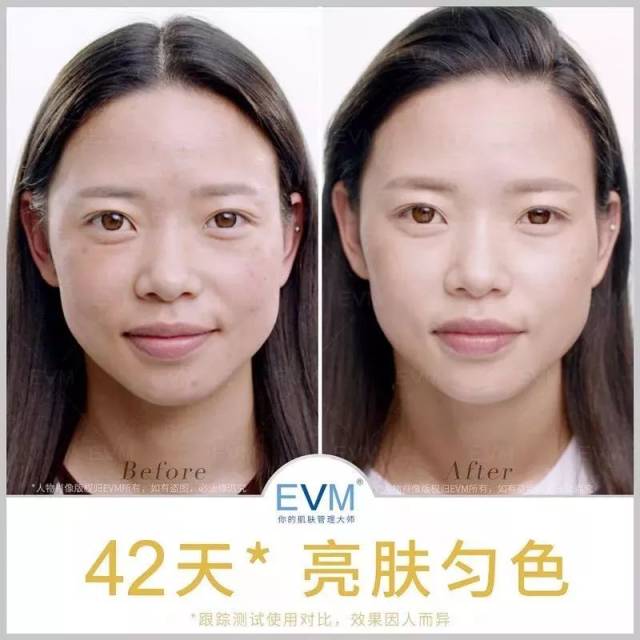 女明星集体变脸,有的更年轻漂亮了,有的却.