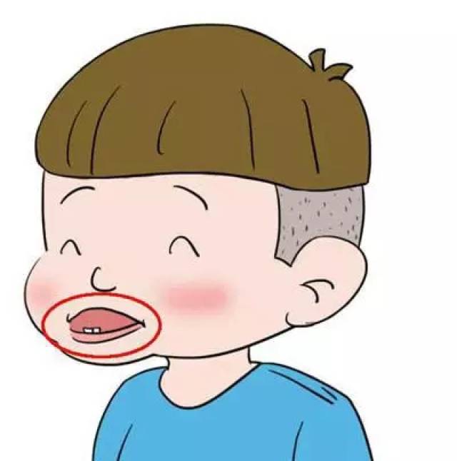 孩子地包天需重视切勿耽误了最佳治疗时间