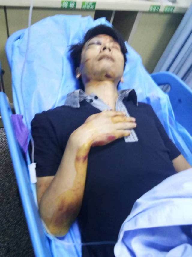 永川33歲男子出車禍致重傷!全城尋找肇事逃逸司機