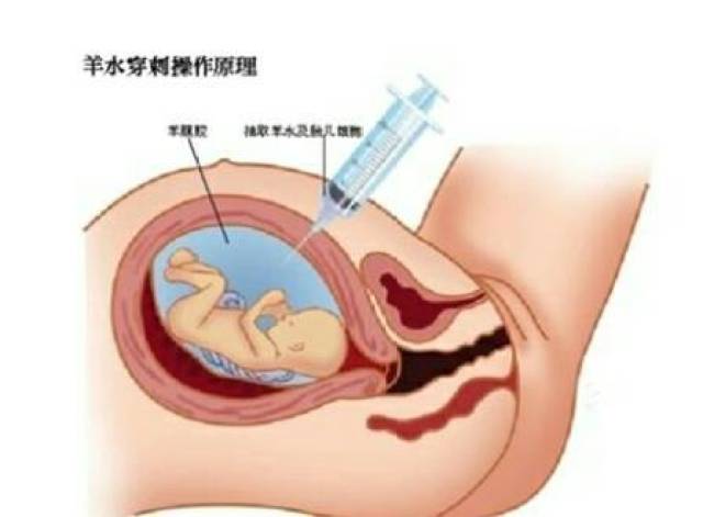 怀孕后这个检查一定不能少,否则等孩子出问题再后悔就晚了!