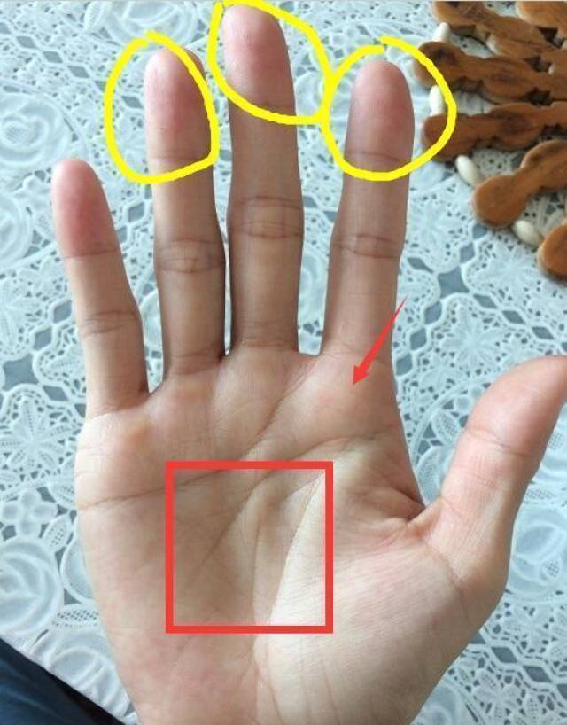 手指有竖纹是什么原因图片