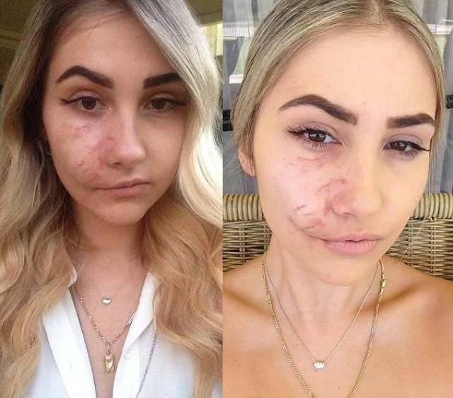 23岁漂亮女模特遭遇恶犬袭击,脸部被咬烂导致毁容
