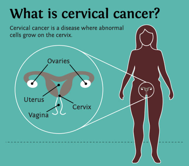 香港如何全面预防宫颈癌,除了打hpv疫苗还要注意什么?【新山医疗】
