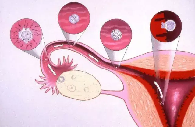 子宫内膜的厚与薄,是怎样影响妊娠率的?