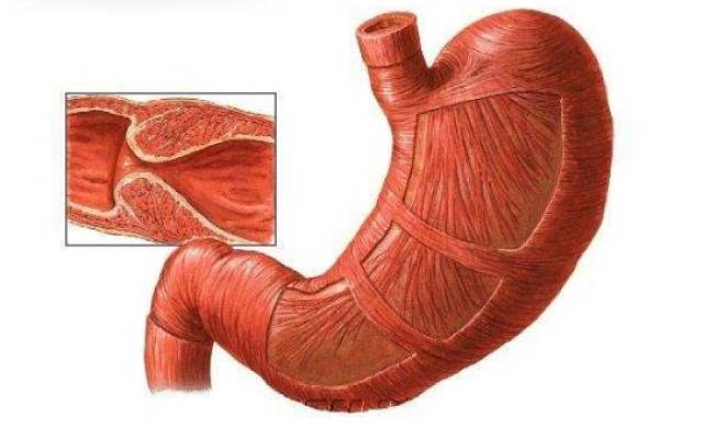 幽门梗阻=胃癌?治疗幽门梗阻应配合中药的辅助治疗