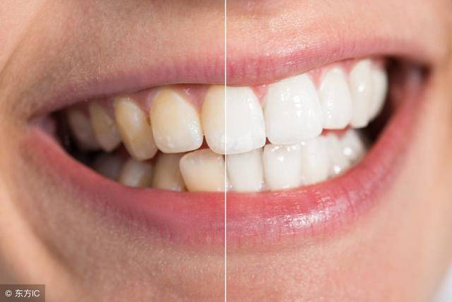 可见明亮的眼睛和洁白的牙齿常作为判断美女的标准,那么牙齿的颜色真